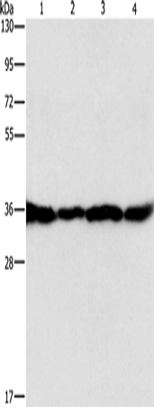 Anti-GNB1 Rabbit Polyclonal Antibody