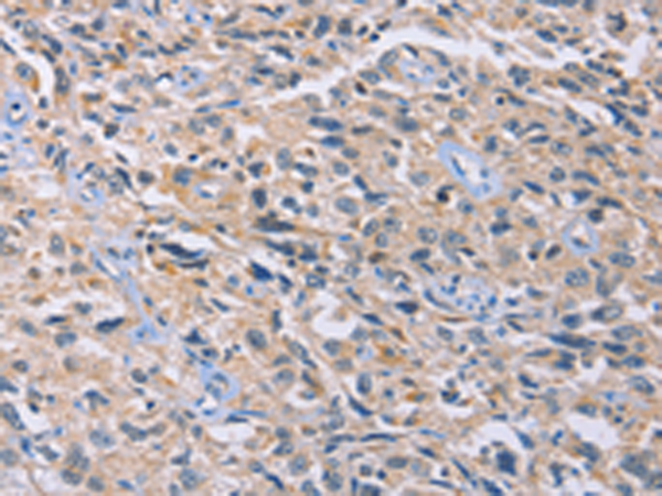Anti-GNB5 Rabbit Polyclonal Antibody