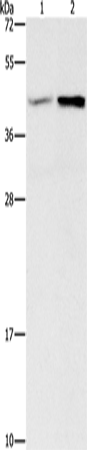 Anti-GNB5 Rabbit Polyclonal Antibody