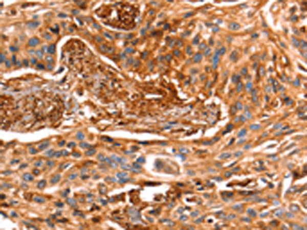 Anti-Galectin 1 Rabbit Polyclonal Antibody