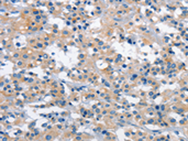 Anti-GAS2 Rabbit Polyclonal Antibody