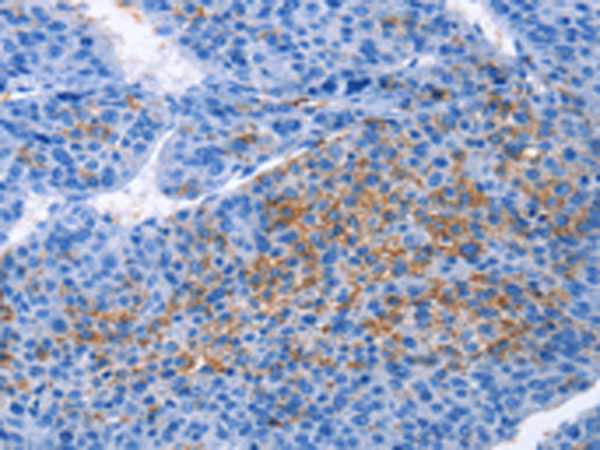 Anti-GRO gamma Rabbit Polyclonal Antibody