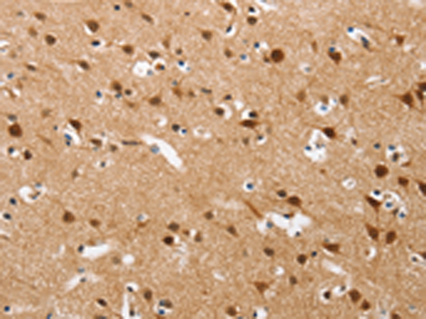 Anti-CXCL14 Rabbit Polyclonal Antibody