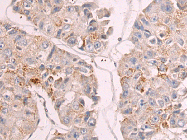 Anti-GDF9 Rabbit Polyclonal Antibody