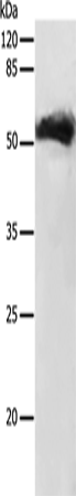Anti-GDF9 Rabbit Polyclonal Antibody