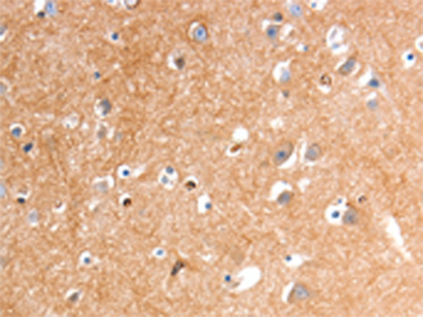 Anti-GLP1R Rabbit Polyclonal Antibody