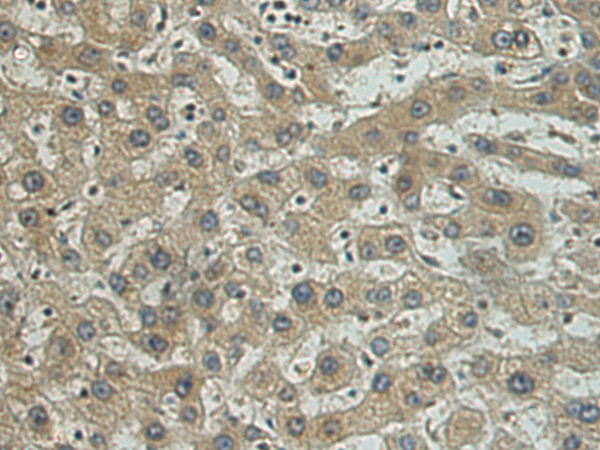 Anti-CSF2 Rabbit Polyclonal Antibody