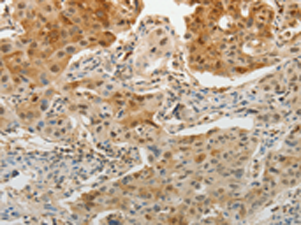 Anti-OGA Rabbit Polyclonal Antibody
