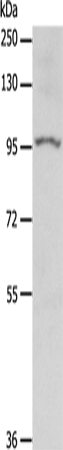 Anti-OGA Rabbit Polyclonal Antibody