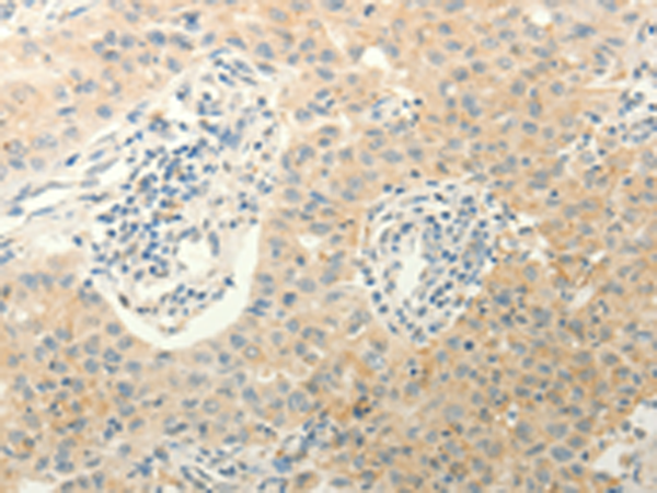 Anti-ERG Rabbit Polyclonal Antibody
