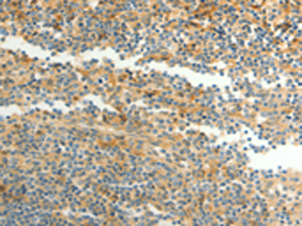 Anti-CFHR1 Rabbit Polyclonal Antibody