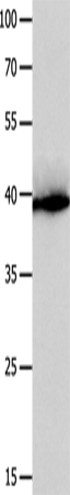 Anti-CFHR1 Rabbit Polyclonal Antibody