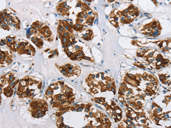 Anti-HINT2 Rabbit Polyclonal Antibody