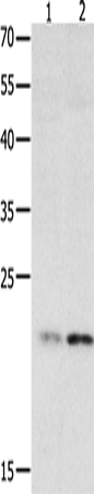 Anti-HMGB4 Rabbit Polyclonal Antibody