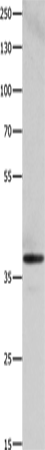 Anti-HMOX2 Rabbit Polyclonal Antibody