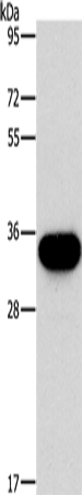 Anti-HOXB13 Rabbit Polyclonal Antibody