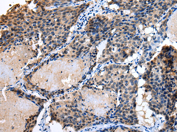 Anti-IL-15 Rabbit Polyclonal Antibody