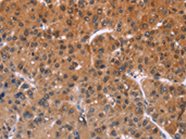 Anti-ING2 Rabbit Polyclonal Antibody