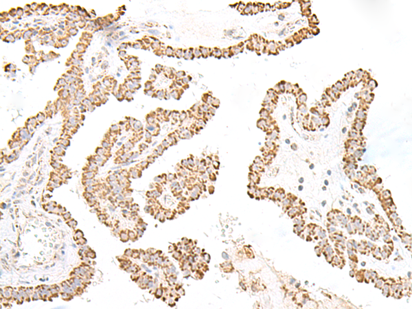 Anti-Integrin beta 6 Rabbit Polyclonal Antibody
