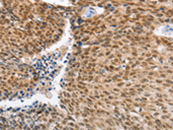Anti-IRF6 Rabbit Polyclonal Antibody