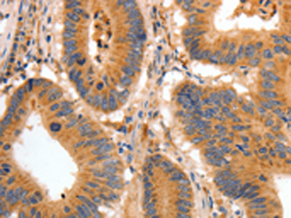 Anti-BAIAP2 Rabbit Polyclonal Antibody
