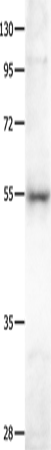 Anti-BAIAP2 Rabbit Polyclonal Antibody