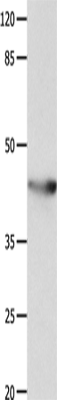 Anti-KCNA5 Rabbit Polyclonal Antibody
