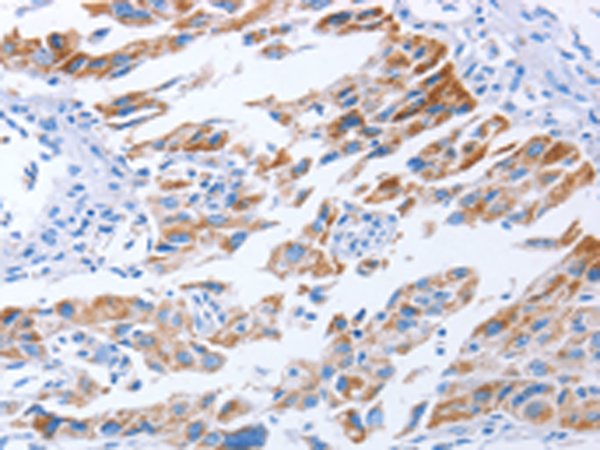 Anti-KIF3A Rabbit Polyclonal Antibody