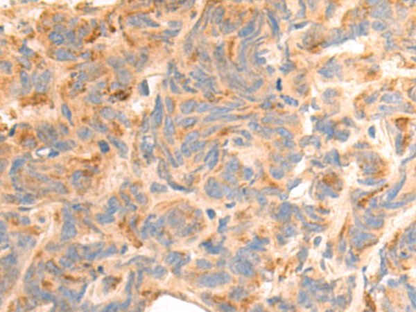 Anti-Kallikrein 4 Rabbit Polyclonal Antibody