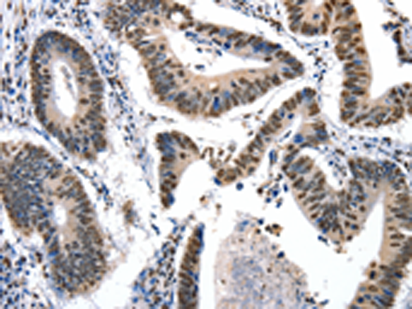 Anti-Kallikrein 7 Rabbit Polyclonal Antibody