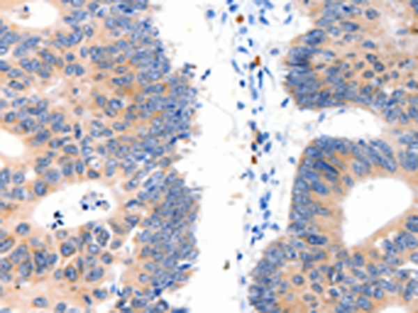 Anti-LAT2 Rabbit Polyclonal Antibody