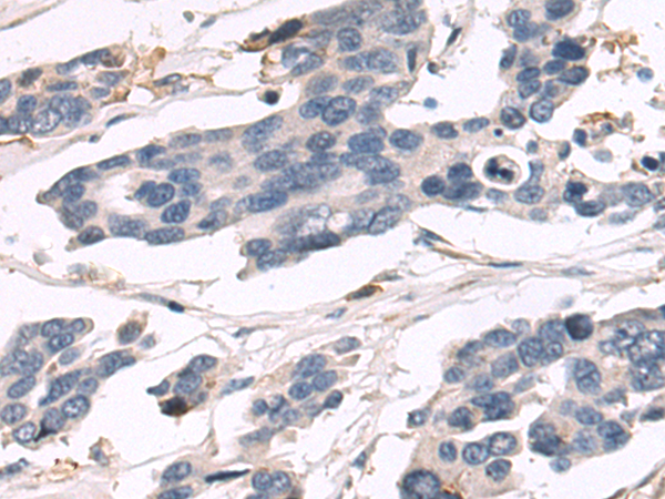 Anti-LAIR1 Rabbit Polyclonal Antibody