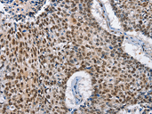 Anti-GNRH1 Rabbit Polyclonal Antibody