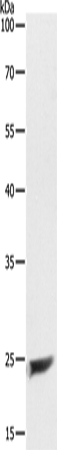 Anti-MAD2L1 Rabbit Polyclonal Antibody