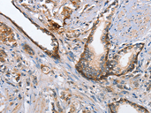 Anti-MAD2L1 Binding Protein Rabbit Polyclonal Antibody