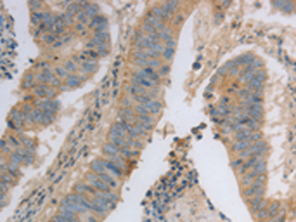 Anti-MAGED1 Rabbit Polyclonal Antibody
