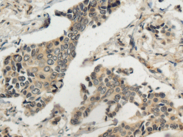 Anti-MASP1 Rabbit Polyclonal Antibody