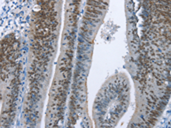 Anti-MCM6 Rabbit Polyclonal Antibody