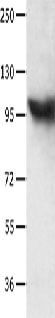 Anti-MCM8 Rabbit Polyclonal Antibody