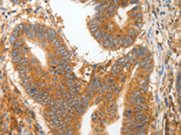 Anti-MMP28 Rabbit Polyclonal Antibody