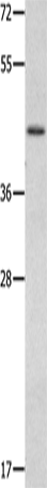 Anti-MMP28 Rabbit Polyclonal Antibody