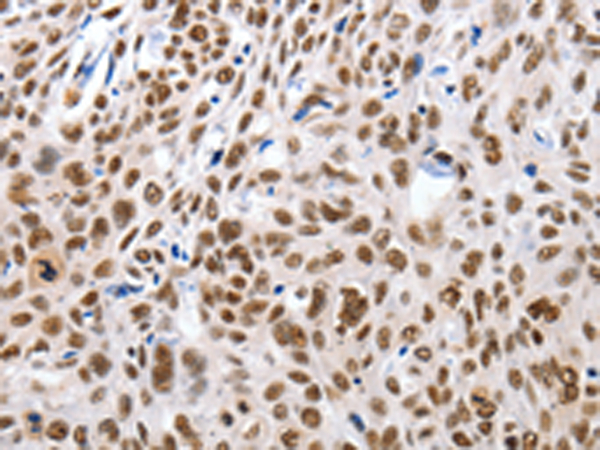 Anti-MSH3 Rabbit Polyclonal Antibody
