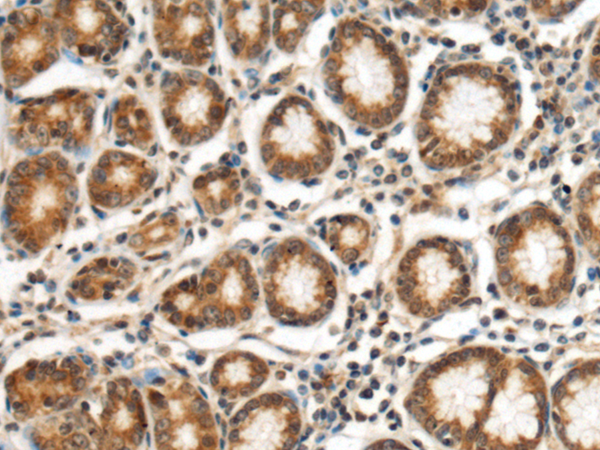 Anti-Myozenin 1 Rabbit Polyclonal Antibody
