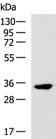Anti-Myozenin 1 Rabbit Polyclonal Antibody