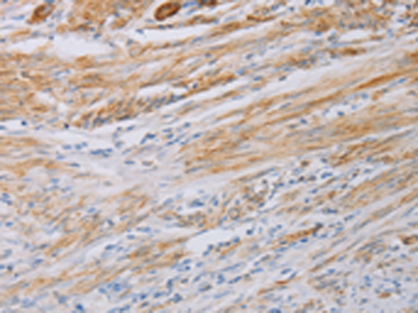 Anti-MYL6 Rabbit Polyclonal Antibody