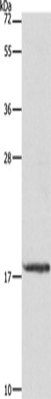Anti-MYL6 Rabbit Polyclonal Antibody