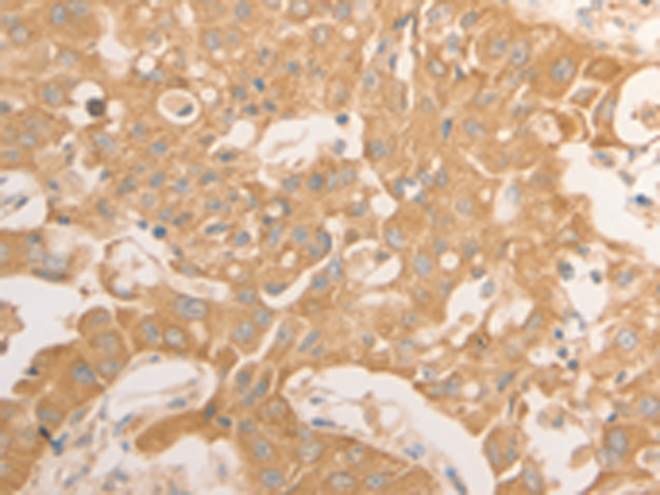 Anti-NAP1L1 Rabbit Polyclonal Antibody