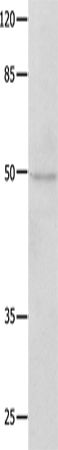 Anti-NAP1L1 Rabbit Polyclonal Antibody