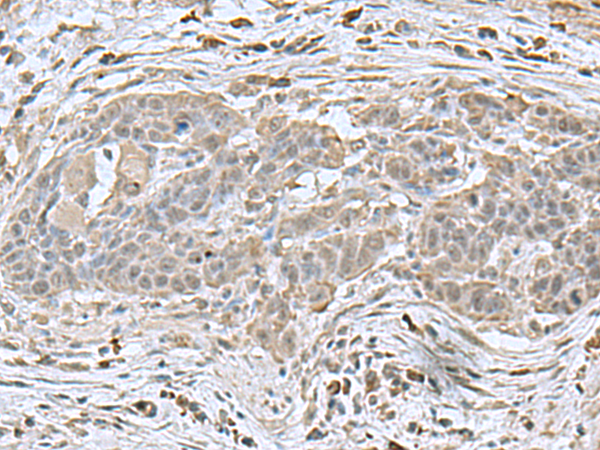 Anti-Neurogenin 3 Rabbit Polyclonal Antibody