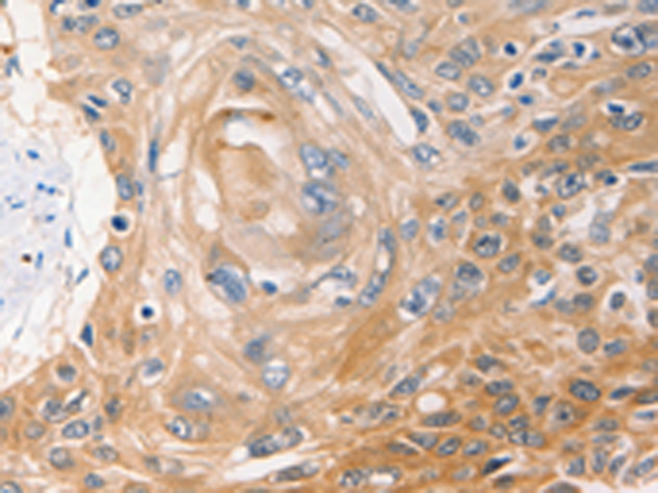 Anti-NM23A Rabbit Polyclonal Antibody